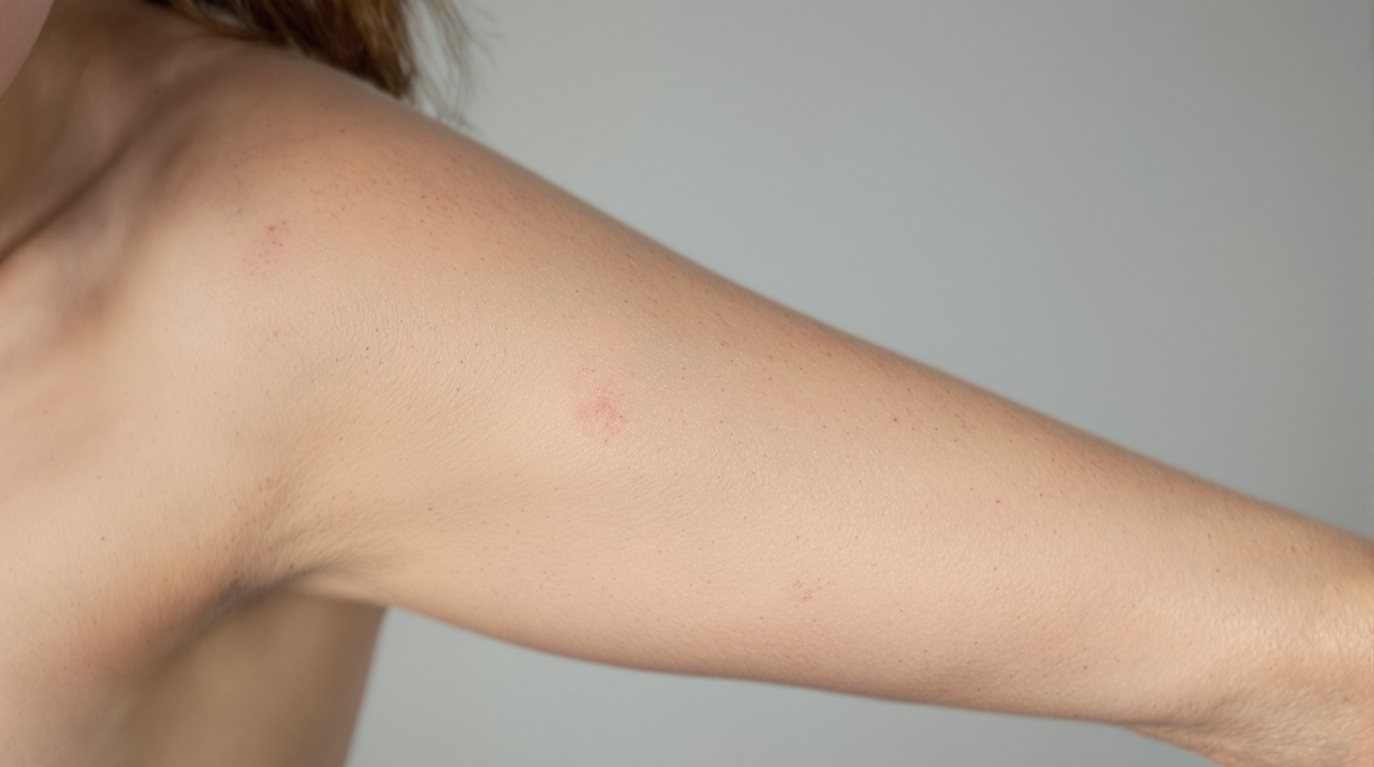 Bras avec une irritation ou une éruption cutanée rougeâtre.